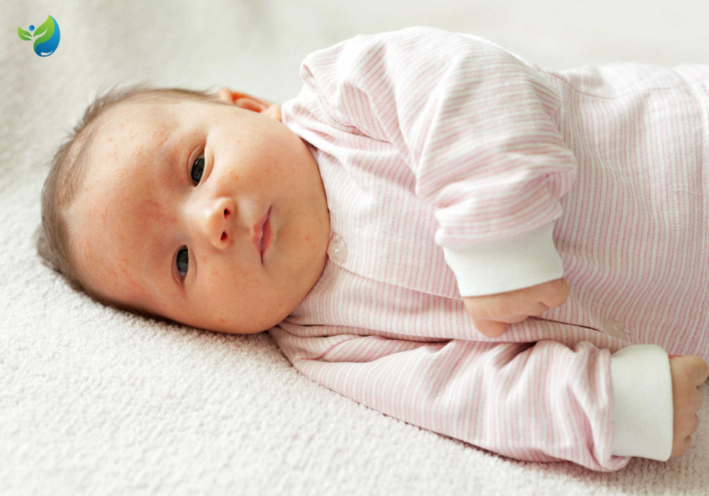 Dấu hiệu rối loạn tiêu hóa ở trẻ sơ sinh 