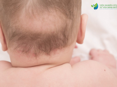 Trẻ sơ sinh bị rụng tóc trên đỉnh đầu