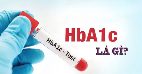 Chỉ số HbA1C bao nhiêu là bị tiểu đường?
